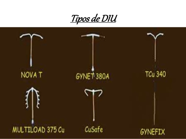 Los DIU de&nbsp;cobre