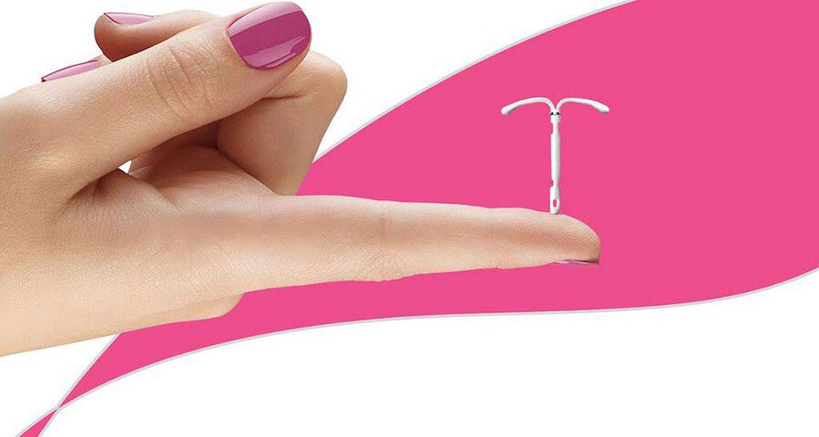 Los DIU con&nbsp;progestágeno