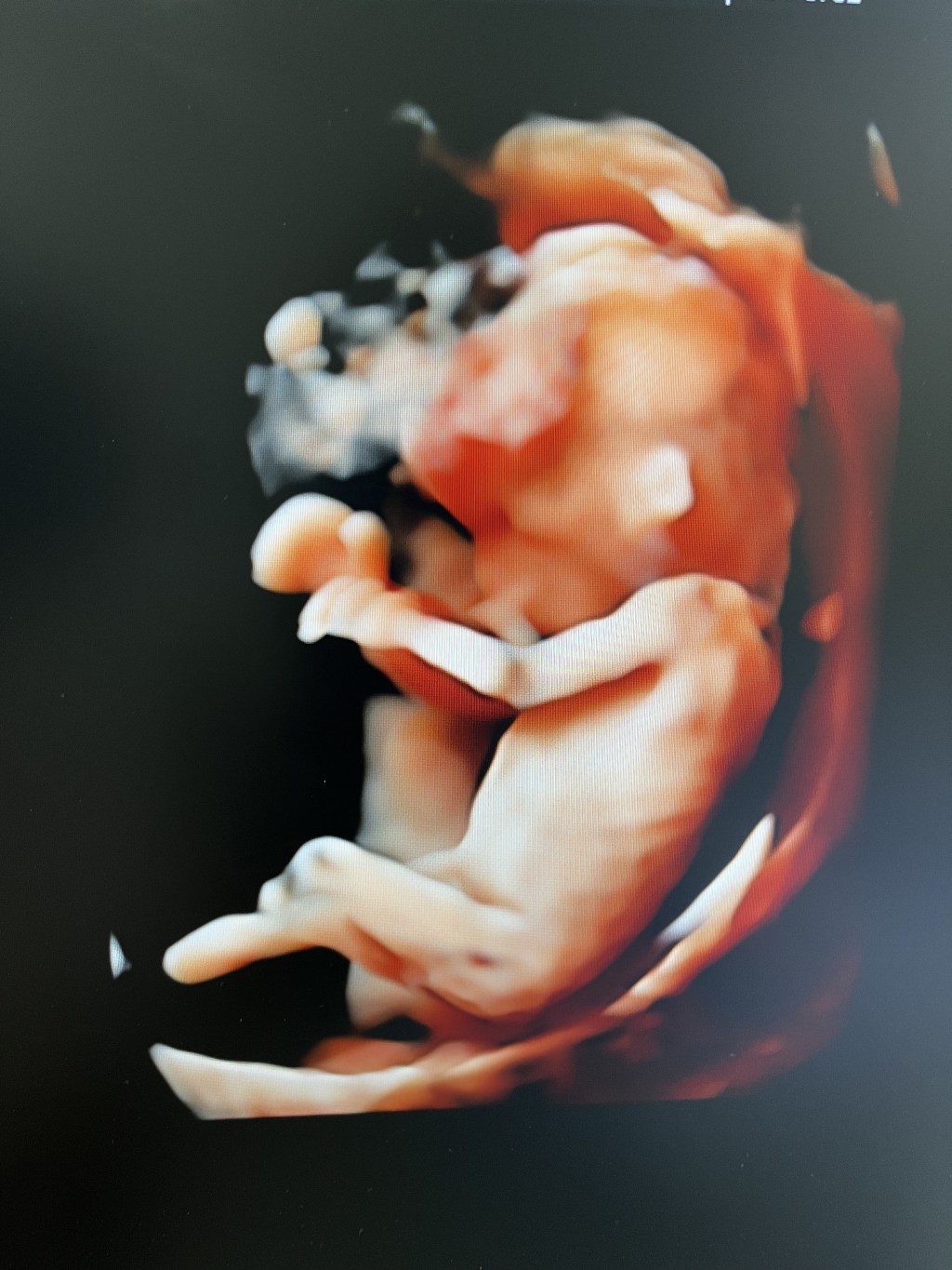 Vacuna vs COVID 19  segura en el&nbsp;embarazo