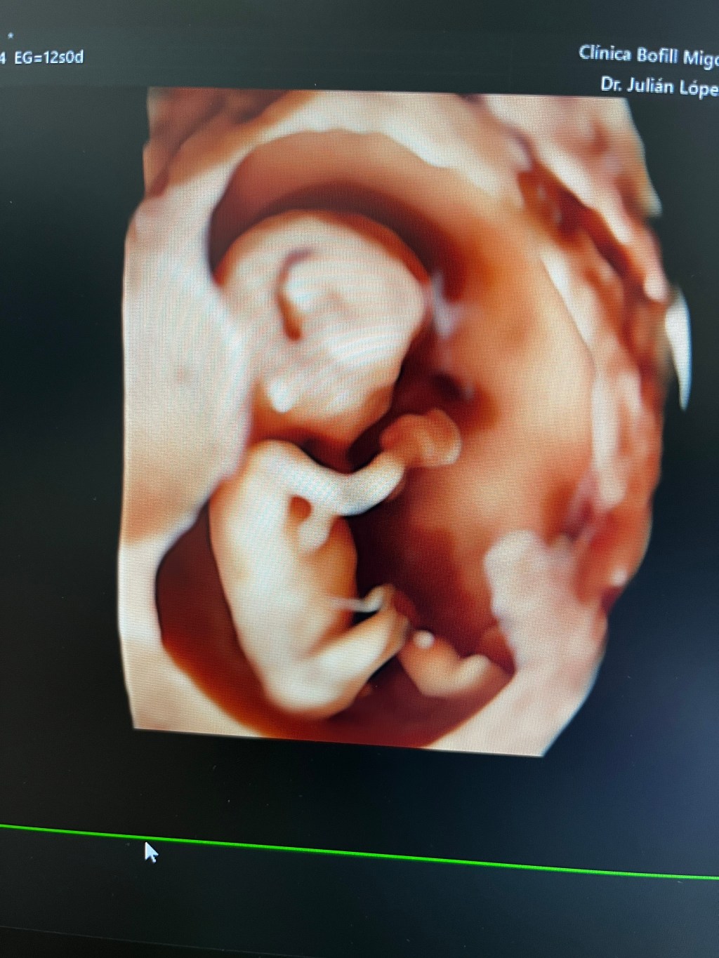 ACOG Tests genéticos&nbsp;prenatales