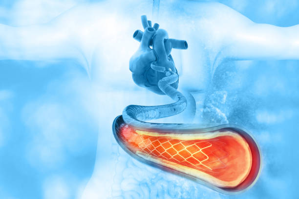 Hemorragia post parto